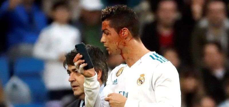 Роналду во время матча с помощью телефона оценил тяжесть своей травмы, Чемпионаты и лиги